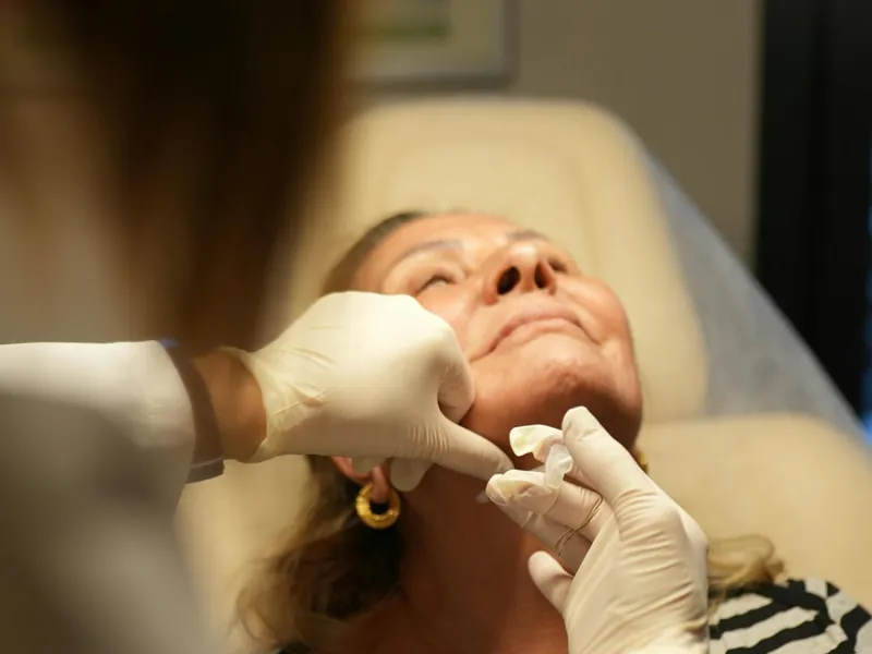 Dermal filler injection treatment