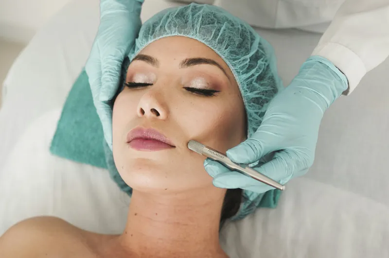 Microneedling with PRF treatment